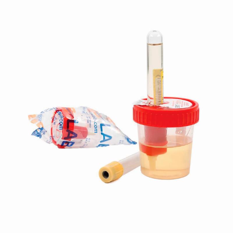 Ємність для сечі MOSLAB з адаптером, ПП, 60 мл., стерил., інд. паков., BPVI00004